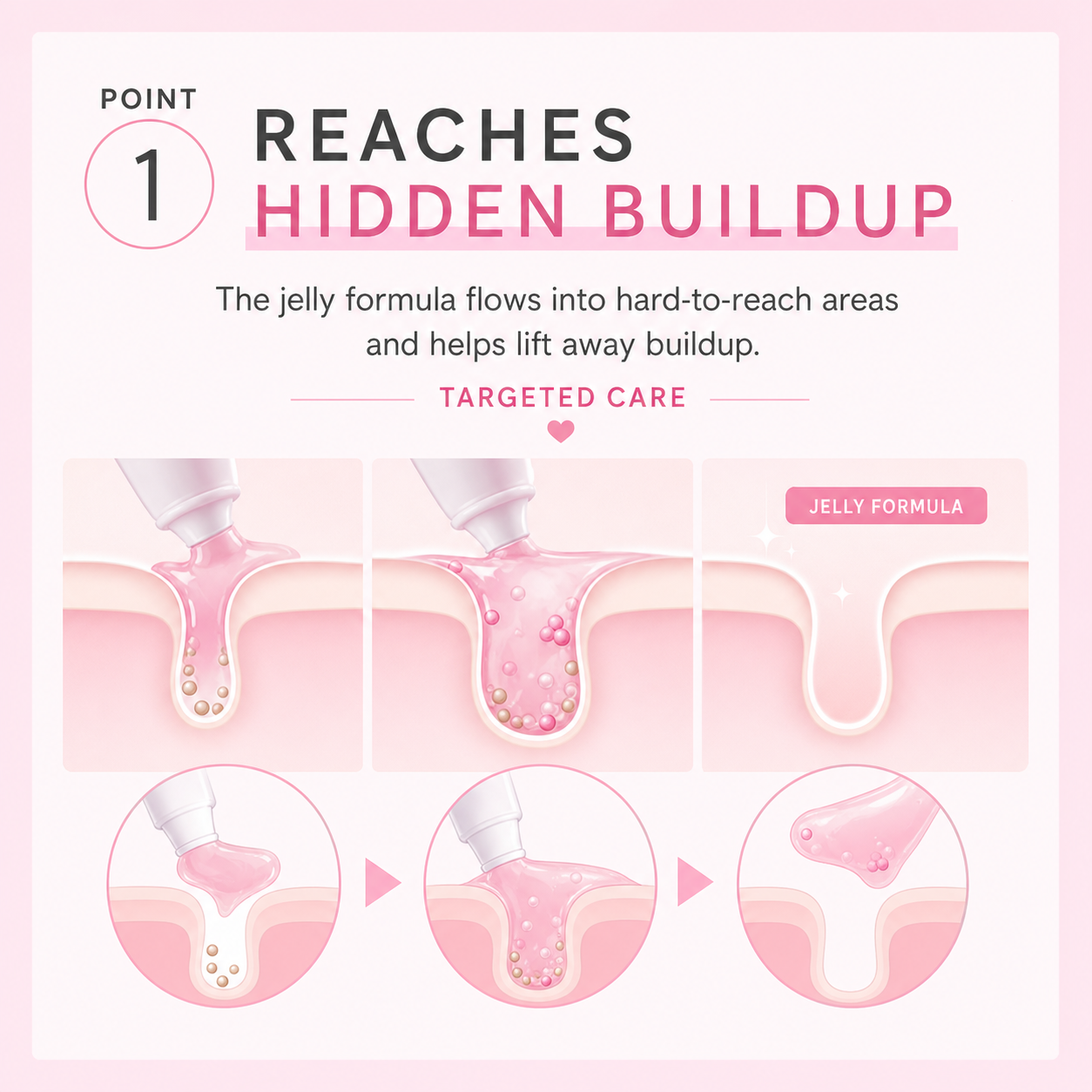 SPOT JELLY point 1 — reaches hidden buildup